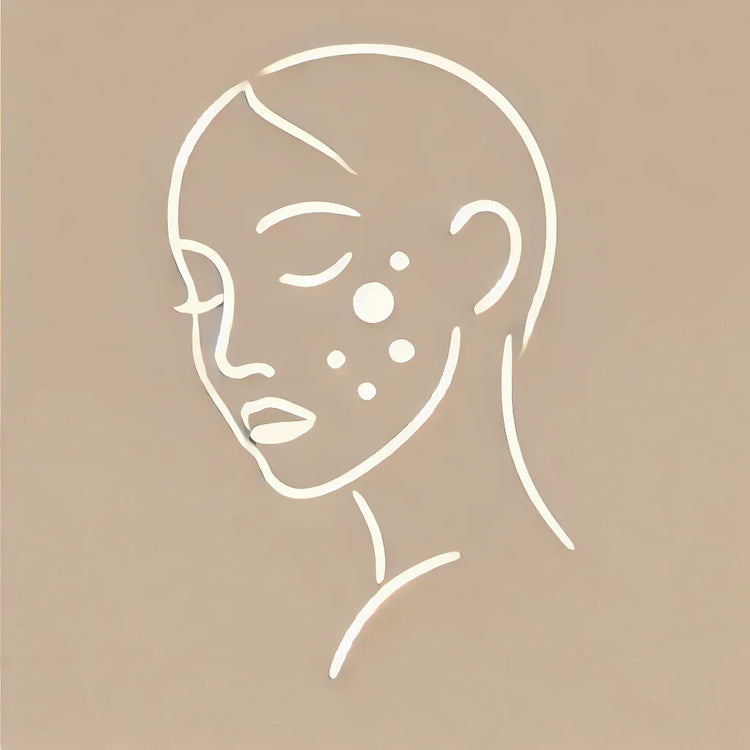 Acne/onzuiverheden